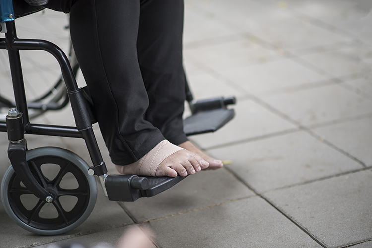 Preventing Falls at Home: A Safety Checklist